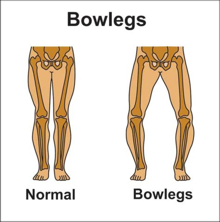 Who is Bowlegged Lou Dating Now